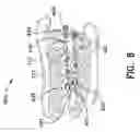 Fig. 27 - Orthodontic apparatus and method