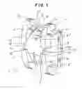 Fig. 02 - Orthodontic Bracket