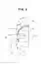 Fig. 03 - Orthodontic Bracket