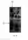 Fig. 09 - BIOMARKERS FOR TOXIC ALGAE