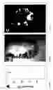 Fig. 18 - Methods and apparatus for the isolation and enrichment of circulating tumor cells