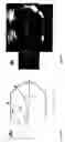 Fig. 24 - Methods and apparatus for the isolation and enrichment of circulating tumor cells