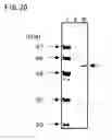 Fig. 21 - AMP deaminase originating streptomyces and utilization thereof
