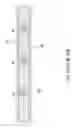 Fig. 05 - Sports board having stringers