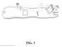 Fig. 04 - Therapy Device to Increase Flexibility and Range of Motion to the Wrist, Fingers, and Thumb