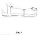 Fig. 09 - Therapy Device to Increase Flexibility and Range of Motion to the Wrist, Fingers, and Thumb