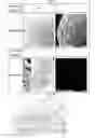 Fig. 05 - Adhesive Bead For Immobilization of Biomolecules and Method For Fabricating a Biochip Using the Same