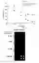 Fig. 07 - Adhesive Bead For Immobilization of Biomolecules and Method For Fabricating a Biochip Using the Same