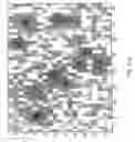 Fig. 16 - METHOD AND A SYSTEM FOR DETERMINATION OF PARTICLES IN A LIQUID SAMPLE