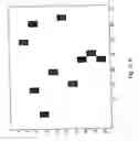 Fig. 17 - METHOD AND A SYSTEM FOR DETERMINATION OF PARTICLES IN A LIQUID SAMPLE