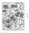 Fig. 16 - Method and a system for determination of particles in a liquid sample
