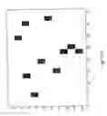 Fig. 17 - Method and a system for determination of particles in a liquid sample