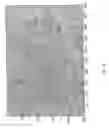 Fig. 18 - Method and a system for determination of particles in a liquid sample