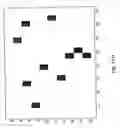 Fig. 17 - METHOD AND A SYSTEM FOR DETERMINATION OF PARTICLES IN A LIQUID SAMPLE