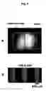 Fig. 10 - Method of Immobilizing Protein, Protein Chip, Method of Immobilizing Cell and Cell Chip