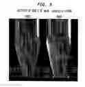 Fig. 04 - Antibacterial peptide with activity against 