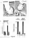 Fig. 07 - CHEC-7 a novel sPLA2 inhibitor