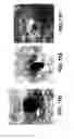Fig. 18 - Methods for Treating Skin Pigmentation