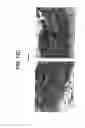 Fig. 22 - Methods for Treating Skin Pigmentation
