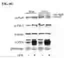 Fig. 15 - Modulation of Inflammation Through Modulation of Elavl1/HuR Expression