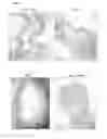 Fig. 23 - Methods and compositions for the treatment of intestinal conditions
