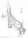 Fig. 07 - SYSTEM FOR USE IN PERFORMING A MEDICAL PROCEDURE AND INTRODUCER DEVICE SUITABLE FOR USE IN SAID SYSTEM