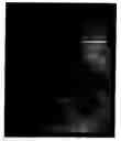 Fig. 01 - Intraoperative Imaging Of Hepatobiliary Structures