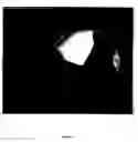 Fig. 03 - Intraoperative Imaging Of Hepatobiliary Structures