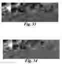 Fig. 33 - SYSTEM AND METHOD TO MEASURE CARDIAC EJECTION FRACTION