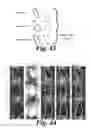 Fig. 40 - SYSTEM AND METHOD TO MEASURE CARDIAC EJECTION FRACTION