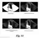 Fig. 47 - SYSTEM AND METHOD TO MEASURE CARDIAC EJECTION FRACTION
