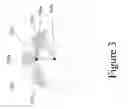 Fig. 04 - TIME-OF-FLIGHT TRIANGULATION BASED METHODS OF DEVICE SPATIAL REGISTRATION FOR MULTIPLE-TRANSDUCER THERAPEUTIC ULTRASOUND SYSTEMS