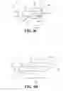Fig. 04 - Vascular Catheter Device and Related Methods of Using the Same