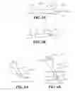Fig. 05 - Vascular Catheter Device and Related Methods of Using the Same