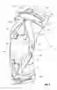 Fig. 10 - Cable-based orthopedic bracing system