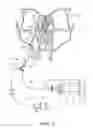 Fig. 04 - Apparatus and method for treatment of ethmoids