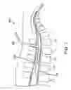 Fig. 03 - Methods for Simultaneous Injection and Aspiration of Fluids During a Medical Procedure