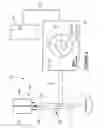 Fig. 03 - Surgical visual feedback and eye fixation method and apparatus