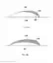 Fig. 05 - Method and Apparatus for Multi-Step Correction of Ophthalmic Refractive Errors