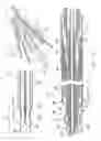 Fig. 07 - METHOD AND APPARATUS FOR APPLYING ENERGY TO BIOLOGICAL TISSUE INCLUDING THE USE OF TUMESCENT TISSUE COMPRESSION
