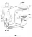 Fig. 13 - System and method for providing even heat distribution and cooling return pads
