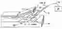 Fig. 01 - Method and apparatus for surgical dissection