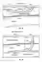 Fig. 02 - Method and apparatus for surgical dissection