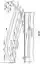 Fig. 11 - Method and apparatus for surgical dissection
