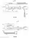 Fig. 18 - Method and apparatus for surgical dissection