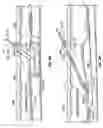 Fig. 25 - Method and apparatus for surgical dissection