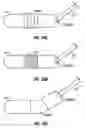 Fig. 31 - Method and apparatus for surgical dissection