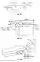 Fig. 33 - Method and apparatus for surgical dissection