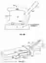 Fig. 34 - Method and apparatus for surgical dissection