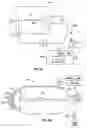 Fig. 38 - Method and apparatus for surgical dissection